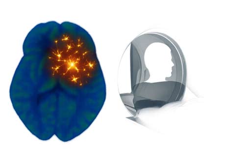 Neuroinflammation in Depression