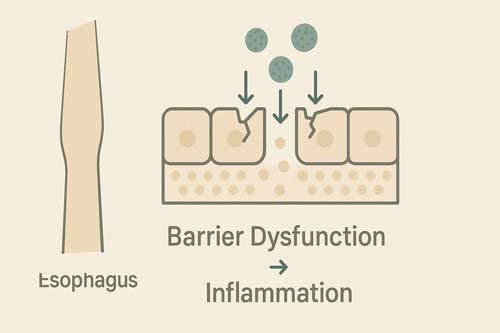 Eosinophilic Esophagitis