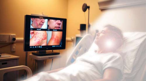 Systemic Rashes