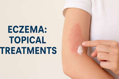 Eczema
