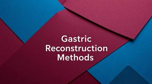 Gastric Reconstructio