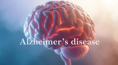 Alzheimer’s Disease