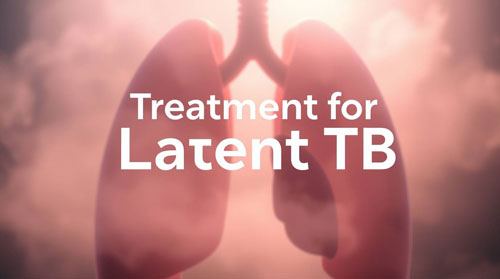  Latent TB