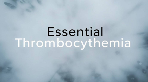 Essential Thrombocythemia