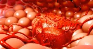 Neutrophils