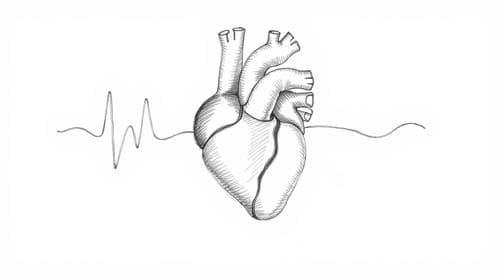 Heart ablation
