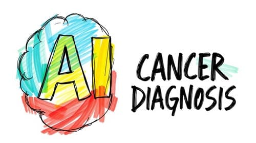 Use of AI in Predicting Cancer Recurrence