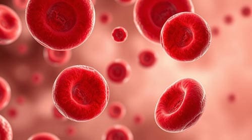 Anemia of Inflammation vs Iron Deficiency Anemia